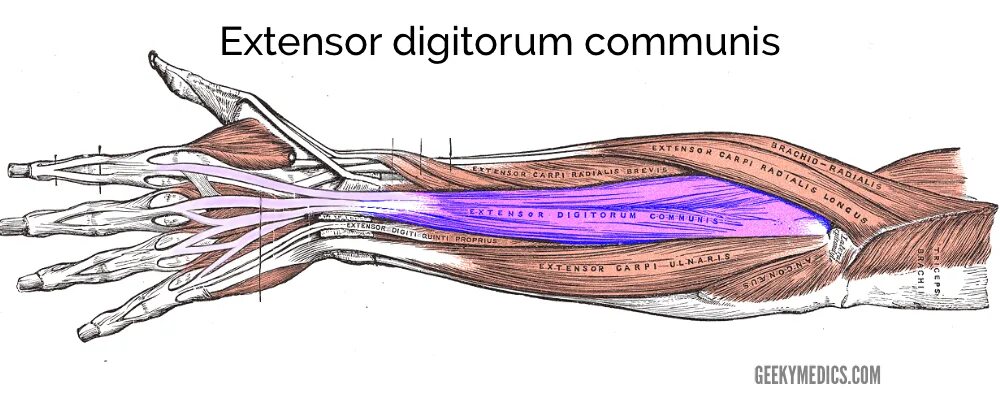 M extensor digitorum. Экстензор carpi ulnaris. экстензор дигиторум. extensor carpi ulnaris muscle. анатомия canalis carpi radialis.