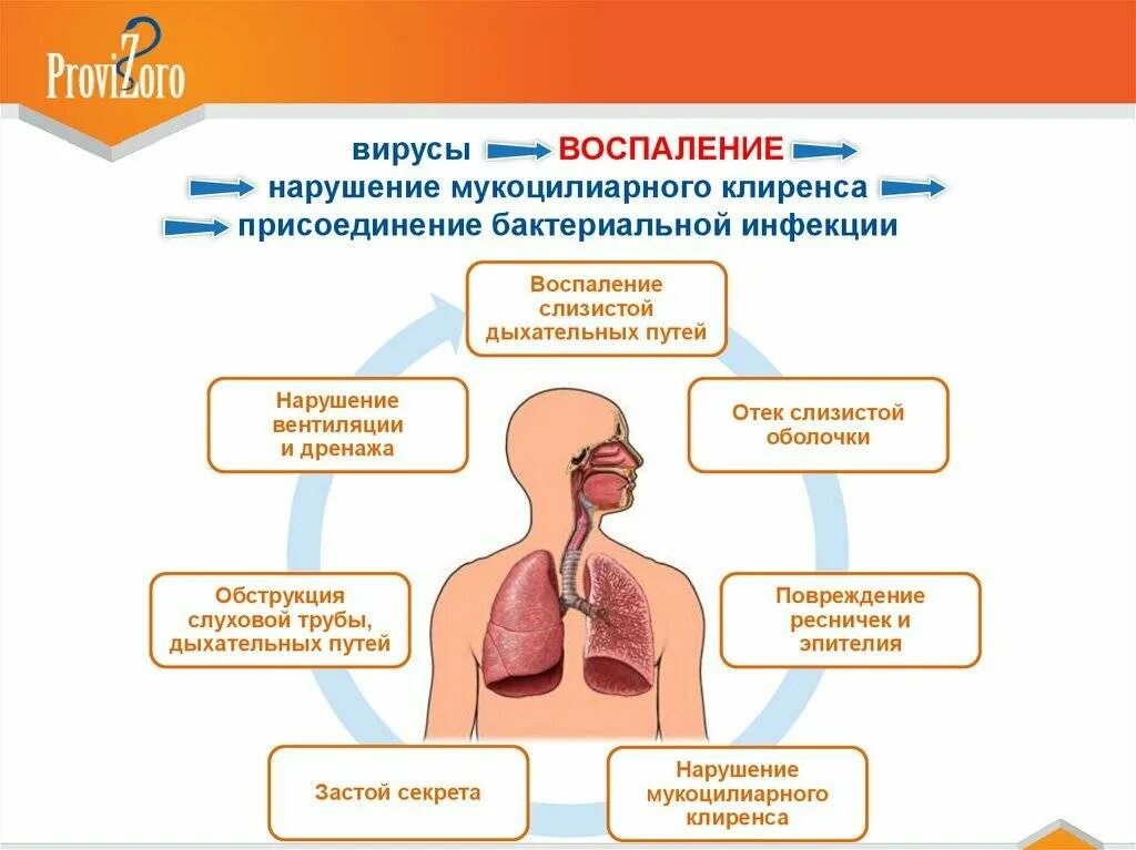 Дыхание при орви. Инфекции верхних дыхательных путей этиология. Острые респираторные вирусные инфекции верхних дыхательных путей. Профилактика инфекций дыхательных путей. Профилактика заболеваний верхних дыхательных путей.