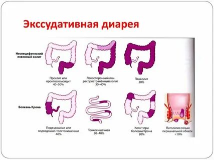 Понос при язве