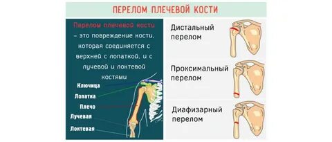 Место сломать