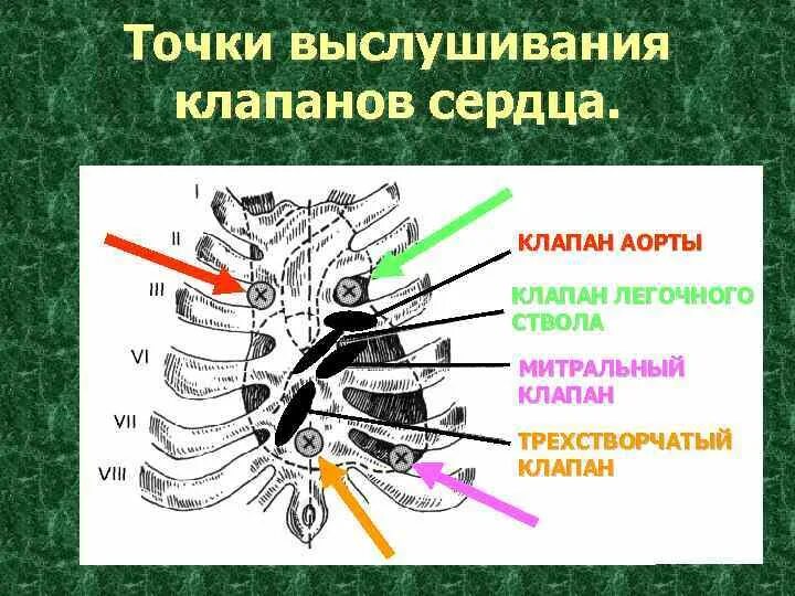 Клапан легочного ствола сердца. Клапан легочного ствола сердца