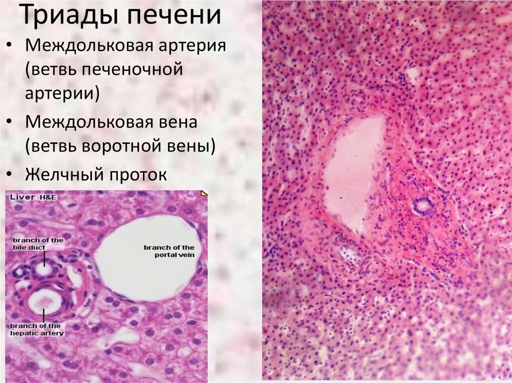 Триада печени. Междольковая Триада печени гистология. Междольковая Вена печени гистология. Междольковая Вена гистология. Печеночная Триада микропрепарат.