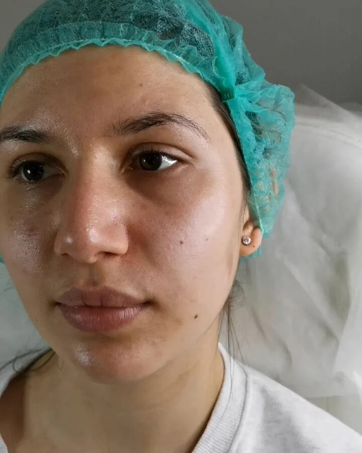 косметолог губы спб