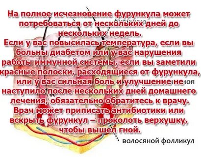 Народные средства вытянуть гной
