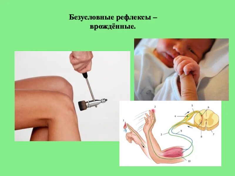 Рефлекторный рисунок. Безусловный рефлекс это в биологии 8 класс. Безусловные рефлексы это рефлексы. Безусловные рефлексы примеры. Примеры безусловных рефлексов у человека.