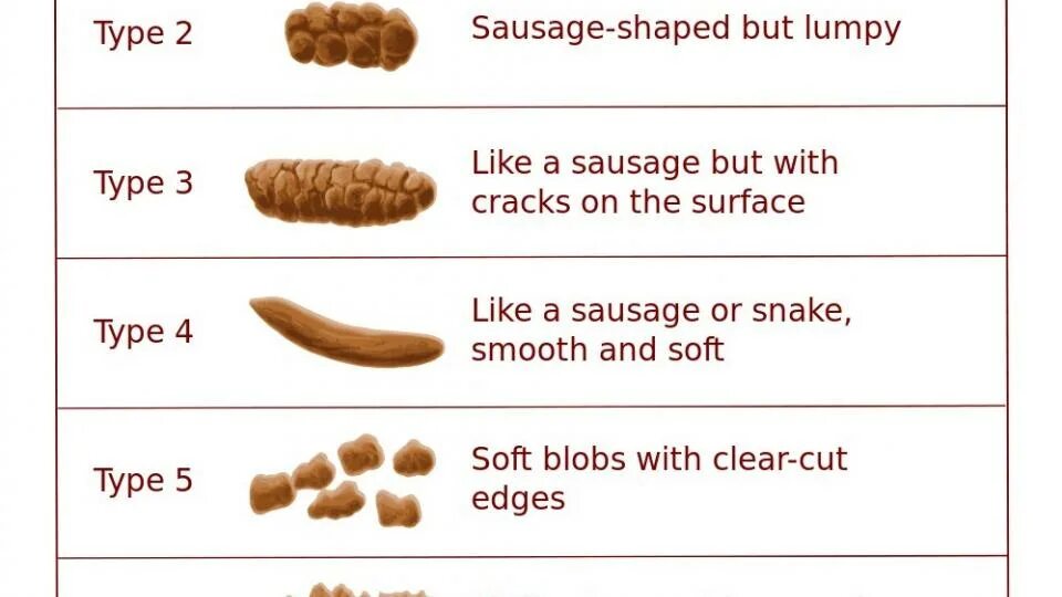 Type like. Types of sausages.