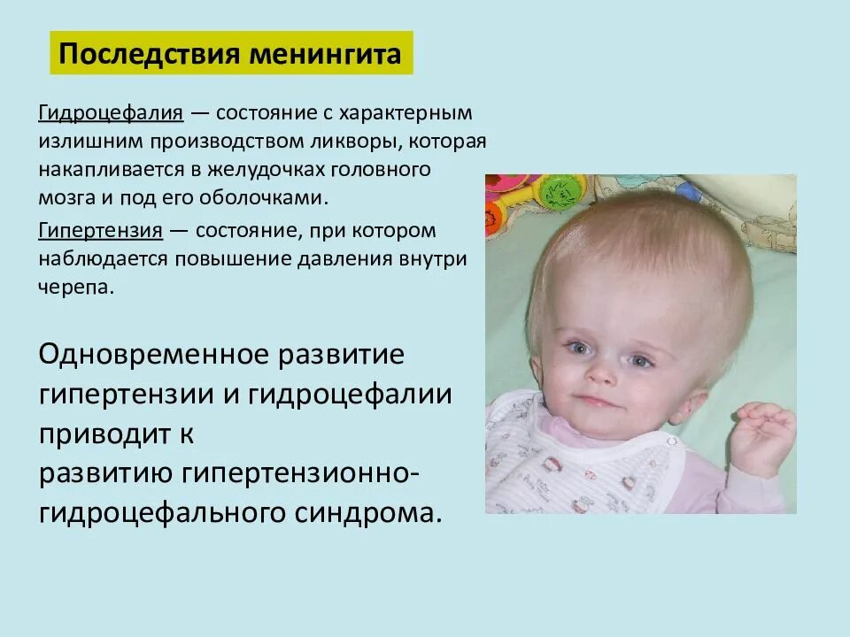 Последствия менингита у взрослых. Осложнения менингококковой инфекции у детей. Последствия менингита у детей. Менингококковая инфекция осложнения и последствия. Осложнения после менингита.