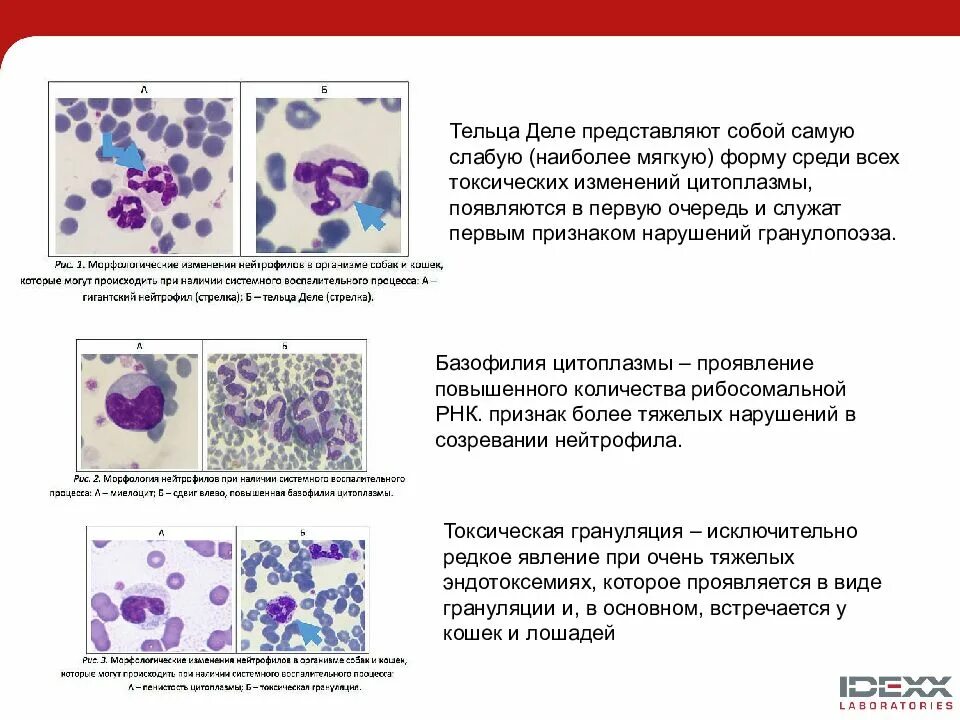 Многочисленные мелкие тельца. Токсигенная зернистость цитоплазмы нейтрофилов. Нейтрофилы морфология и развития. Вакуолизация лейкоцитов. Морфология: токсигенная зернистость нейтрофилов.