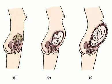 Турбулентті кеудесі бар әйелдердің фотосуреттері