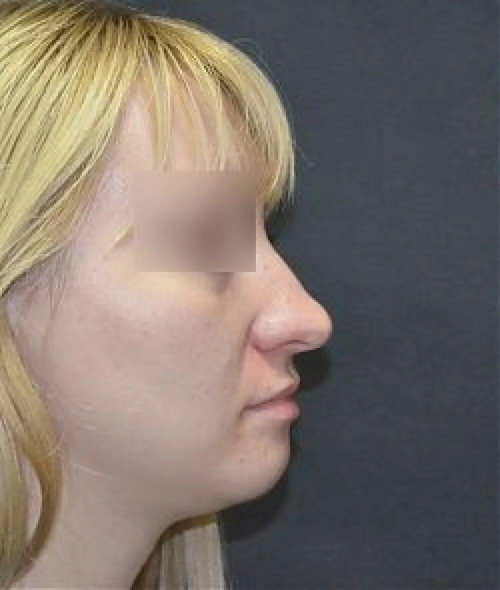 сон страшный нос