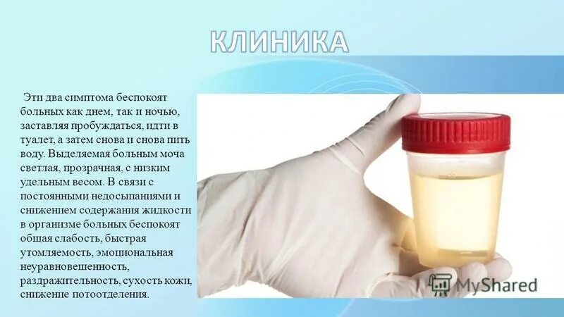 Что значит если моча прозрачная как вода. Цвет мочи норма. Что значит если моча прозрачная как вода. Нормальный цвет мочи. Прозрачная моча.