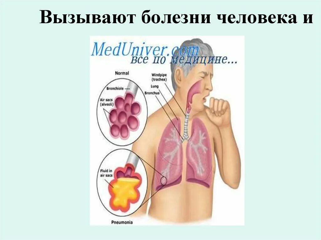 5 заболеваний вызванных бактериями. Болезни вызываемые бактериями. Болезни вызываемые бактериями 5 класс. Заболевания человека вызываемые микроорганизмами. Профилактика бактериальных заболеваний человека.