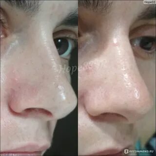 Поры забиты маслом