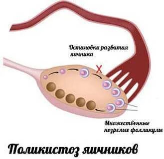 Доминантная фолликула в яичнике что это