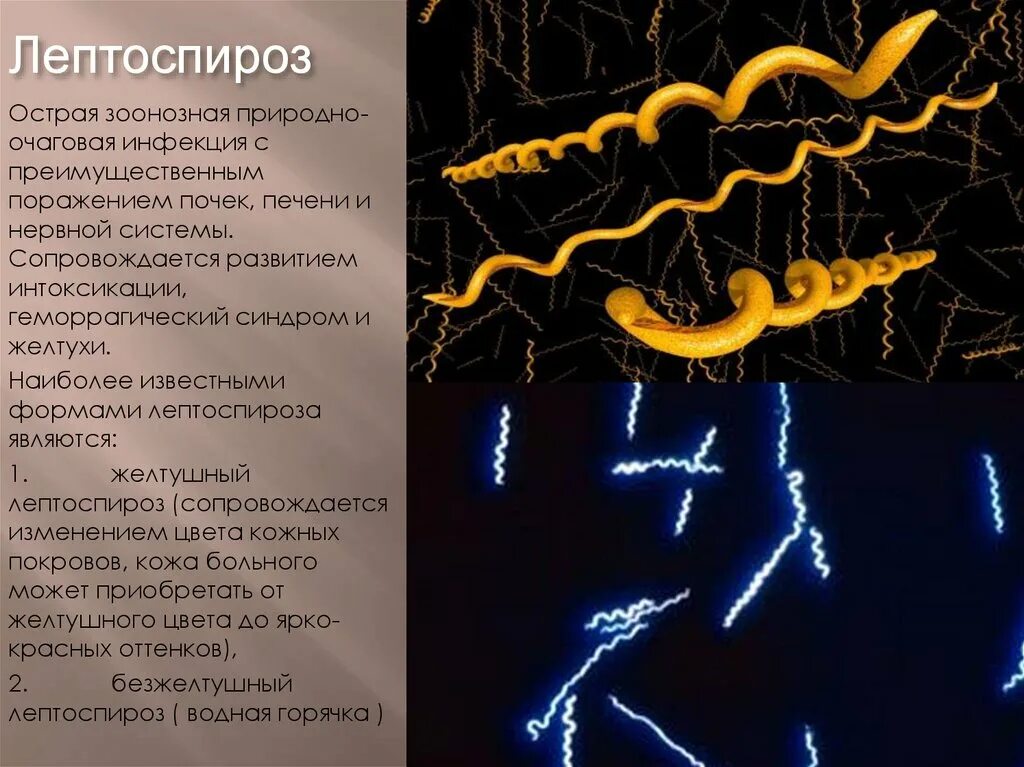 Лептоспироз инфекционный. Безжелтушная форма лептоспироза клиника. Лептоспироз презентация у человека. Лептоспиры заболевания.