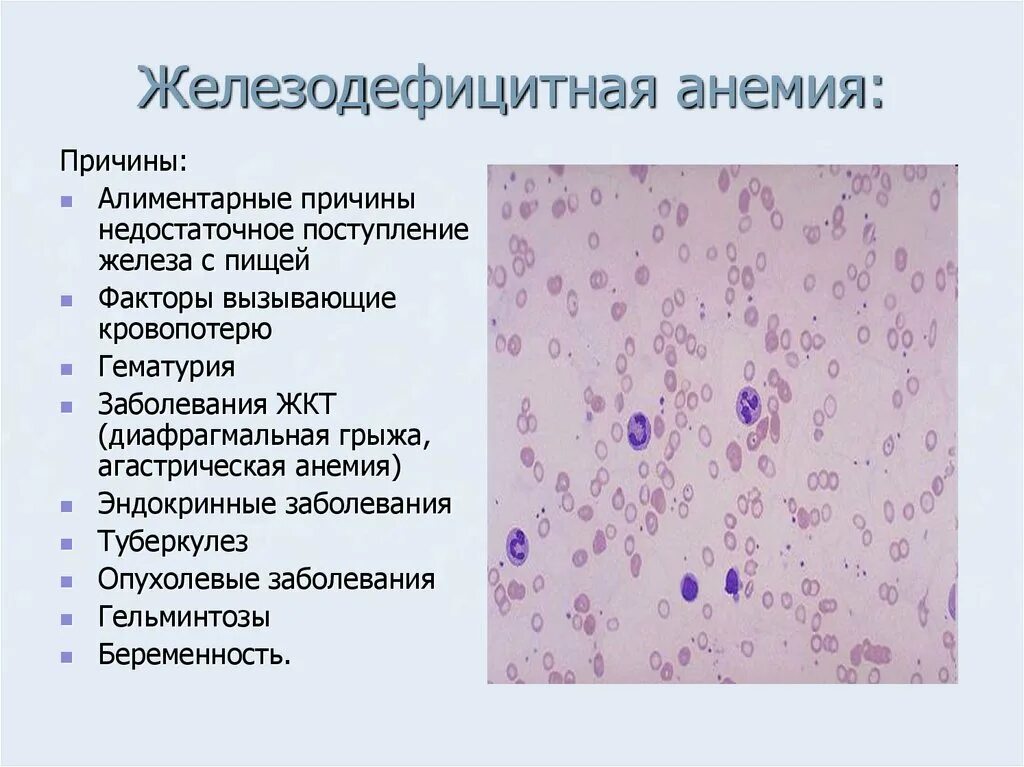 Причиной железодефицитной анемии является. При железодефицитной анемии наблюдается повышение. Причины жда. Причины жда анемии. Факторы жда.