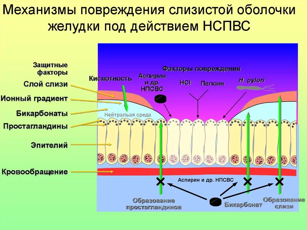 Защитные барьеры слизистой оболочки желудка. Повреждение слизистой оболочки. Повреждение слизистой оболочки желудка. Повреждение слизистой ЖКТ.