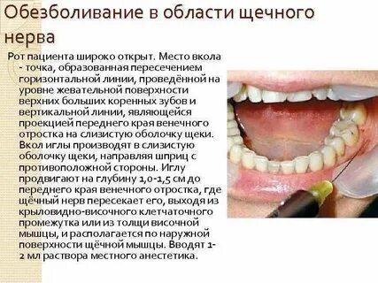 Анестезия зуба не проходит
