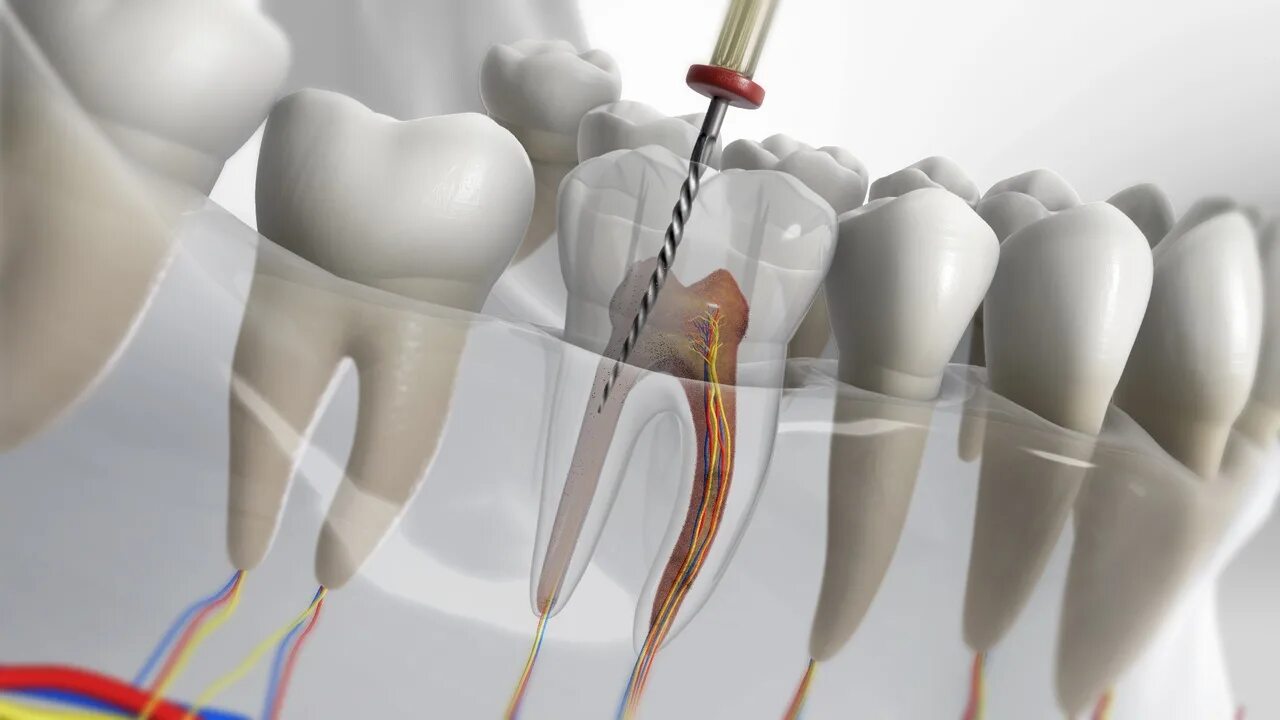 Root canal. Эндодонтия 2.5.