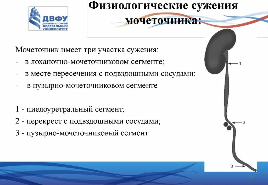 Лечение мочеточников у мужчин. 3 Физиологических сужения мочеточника. Мочеточник строение части. Сужения мочеточника анатомия. Физиологические изгибы мочеточника.