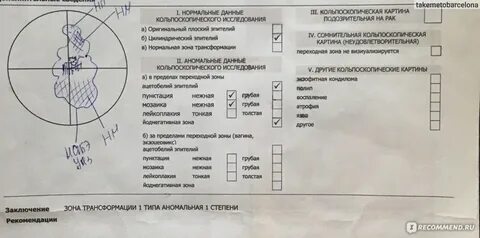 Кольпоскопия тип 1