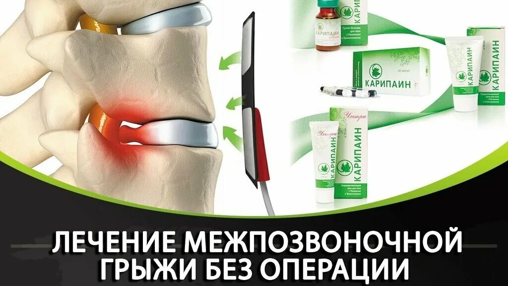 350 пе 10мл. карипазим папайи млечный сок. лекарство для электрофореза карипазим. карипаин в ампулах для электрофореза. невотон элфор плюс.