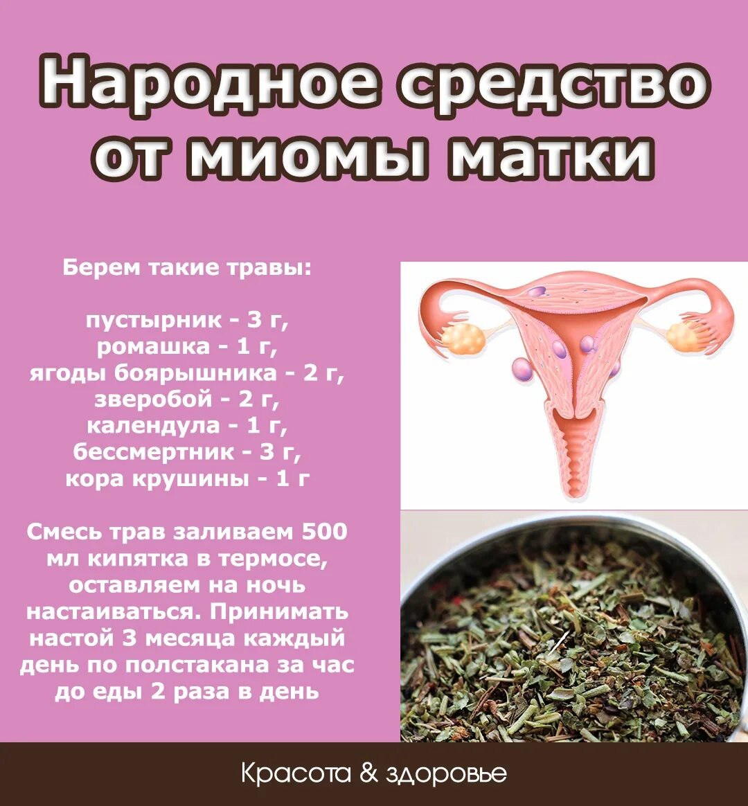 Народные средства от миомы матки. Миома матки народные средства. Народные средства от фибромиомы матки. Многоузловая миома матки. Матки что можно пить