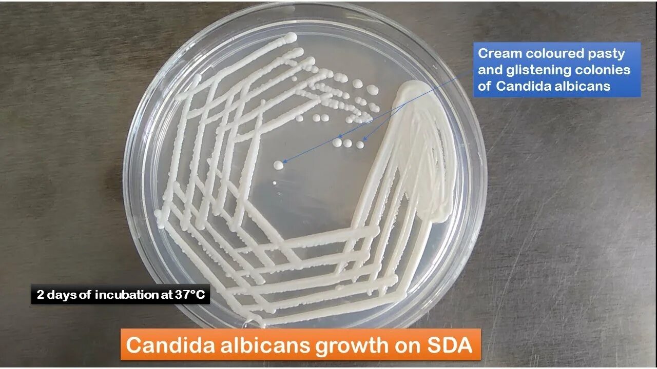 Антитела к candida albicans. Кандида альбиканс систематика. ростовые трубки candida albicans. candida albicans var albicans норма.