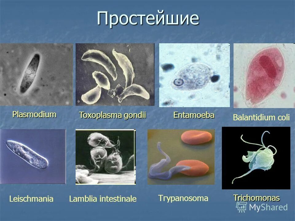 Заболевания простейших животных. Биологии 7 класс паразитические простейшие типы. Токсоплазма протисты. Простейшие паразиты. Виды паразитических простейших.