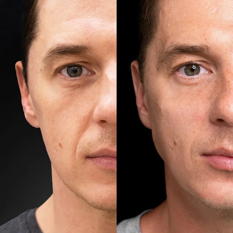 волевой подбородок у мужчин фото. мужские скулы до и после. мьюинг результаты. впалые щеки у мужчин. квадратная челюсть у мужчины.