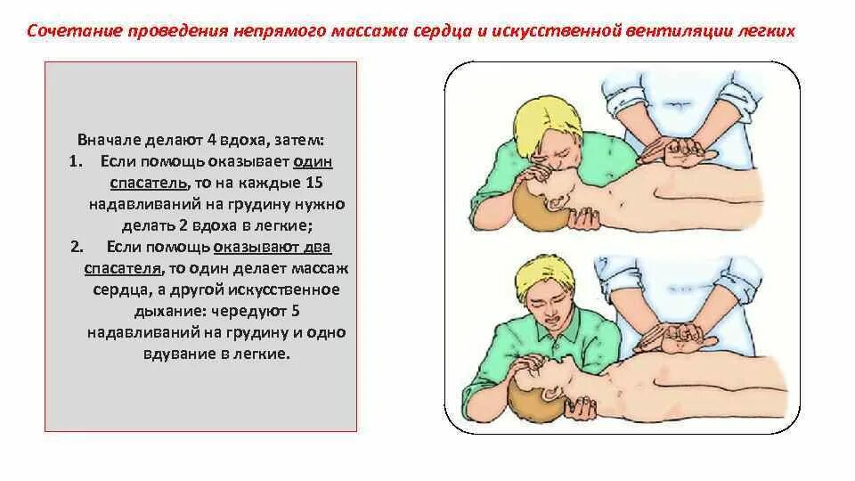 Искусственная вентиляция легких и непрямой массаж сердца. Проведение искусственного дыхания и непрямого массажа сердца. Непрямой массаж сердца и искусственную вентиляцию. Проведение ивл и непрямого массажа. Искусственная вентиляция лёгких и непрямой массаж сердца.