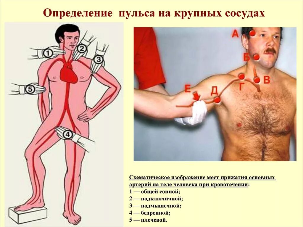 Пульс на какой артерии. Места изменения пульса. места измерения пульса у человека. артерии для определения пульса. места пульсации артерий.