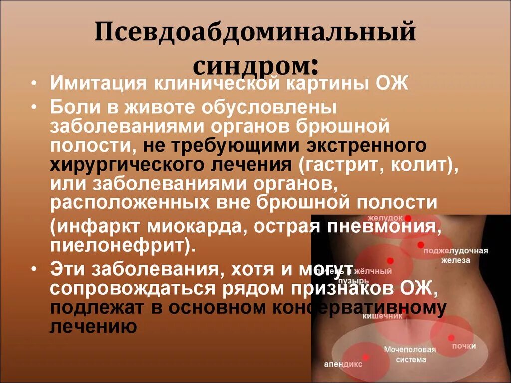 Заболевания при остром животе. Псевдоабдоминальный синдром. Заболевания органов брюшной полости. Острый живот презентация по хирургии. Синдром повреждения органов брюшной полости