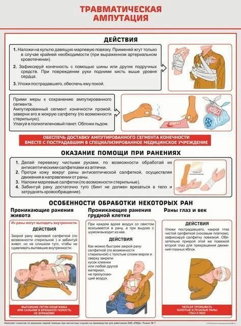 Травматическая ампутация конечности. Оказание первой помощи при травматической ампутации. Травматическая ампутация конечности первая помощь. Травматическая ампутация пальца. Действия при травматической ампутации