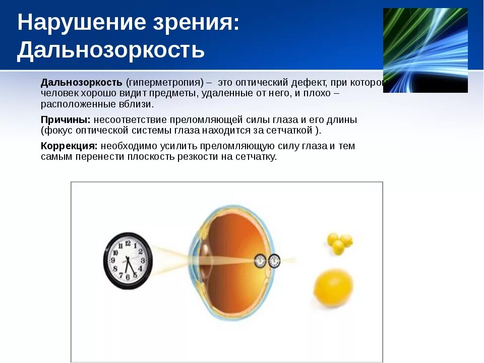 Дефекты зрения ответы. Причины дальнозоркости. Дальнозоркость развивается при. Гиперметропия причины. Дефекты зрения дальнозоркость.