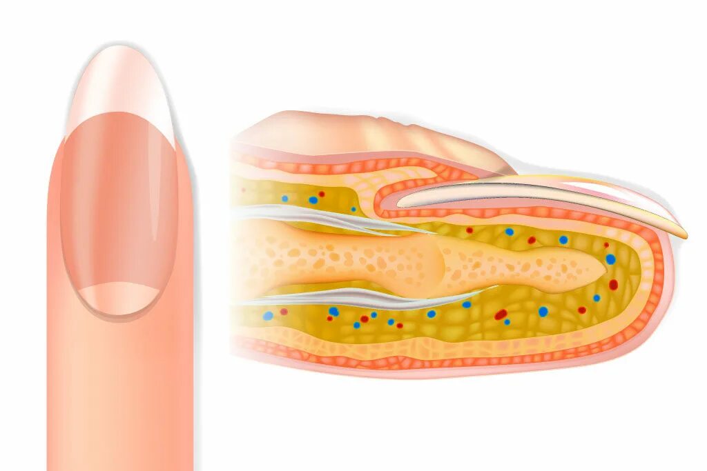 Ногтевой покров. Панариций ногтевой пластинки. Строение ногтя. Строение пальца и ногтя. Ноготь в разрезе.