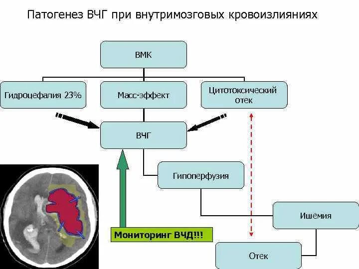 Внутричерепная гипертензия лечение у взрослых