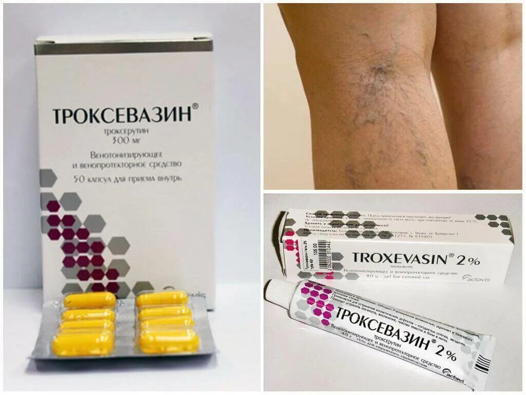 троксевазин капсулы. капсулы троксевазин при варикозе. капсулы троксевазин при варикозе. троксевазин капсулы 300мг №50. капсулы троксевазин при варикозе.