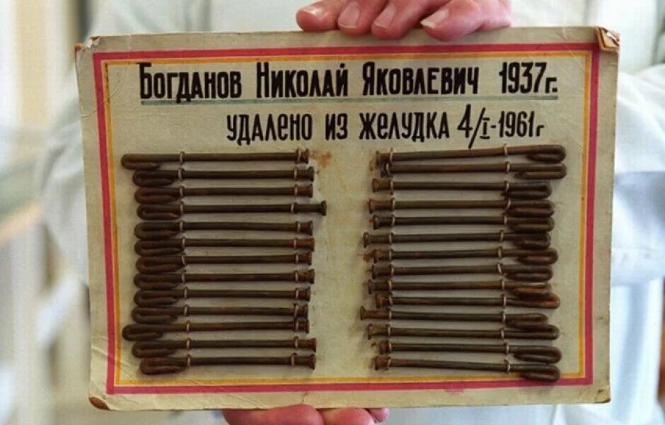 Какие предметы достают из. Предметы извлеченные из. предметы извлеченные из желудка. вещи зеков.