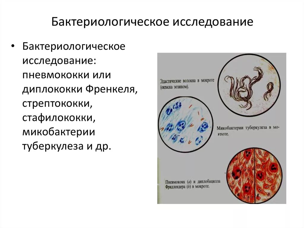 Инфекция с мокротой. Диплококки менингококки пневмококки гонококки. Пневмококки бактериологическое исследование. Бактериологический метод исследования пневмококковой инфекции.