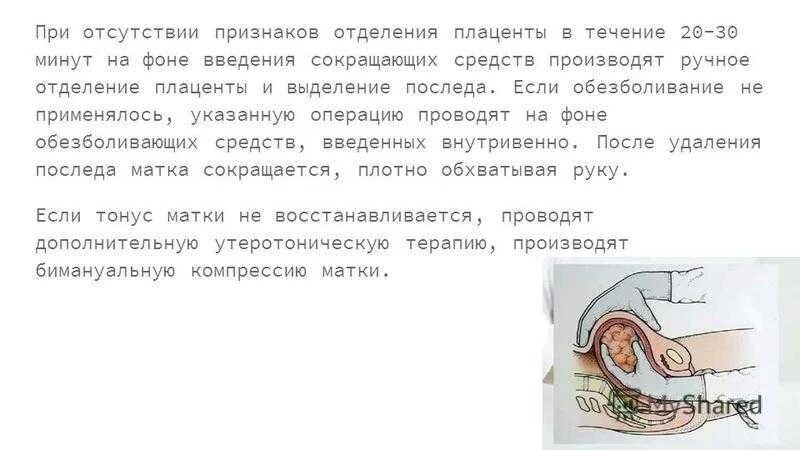 Ошибка врачей при родах