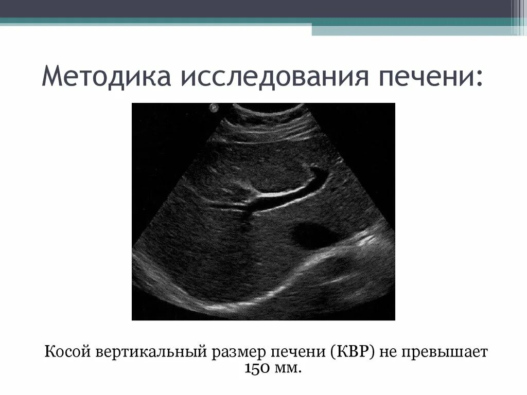 4 размера печени. КВР печени УЗИ. Нормальная структура печени на УЗИ. Косо вертикальный размер печени. Косой вертикальный размер печени.