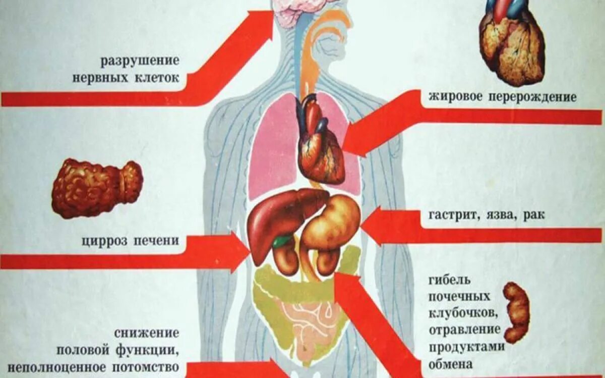 Виски орган человека