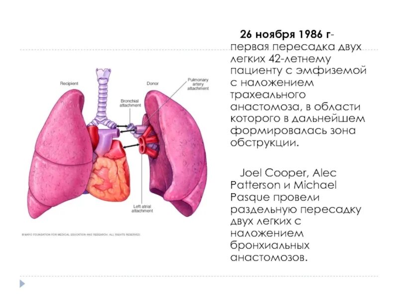 Хирургическая анатомия легких. Трансплантация легких. Трансплантология легких. 23.11 1986