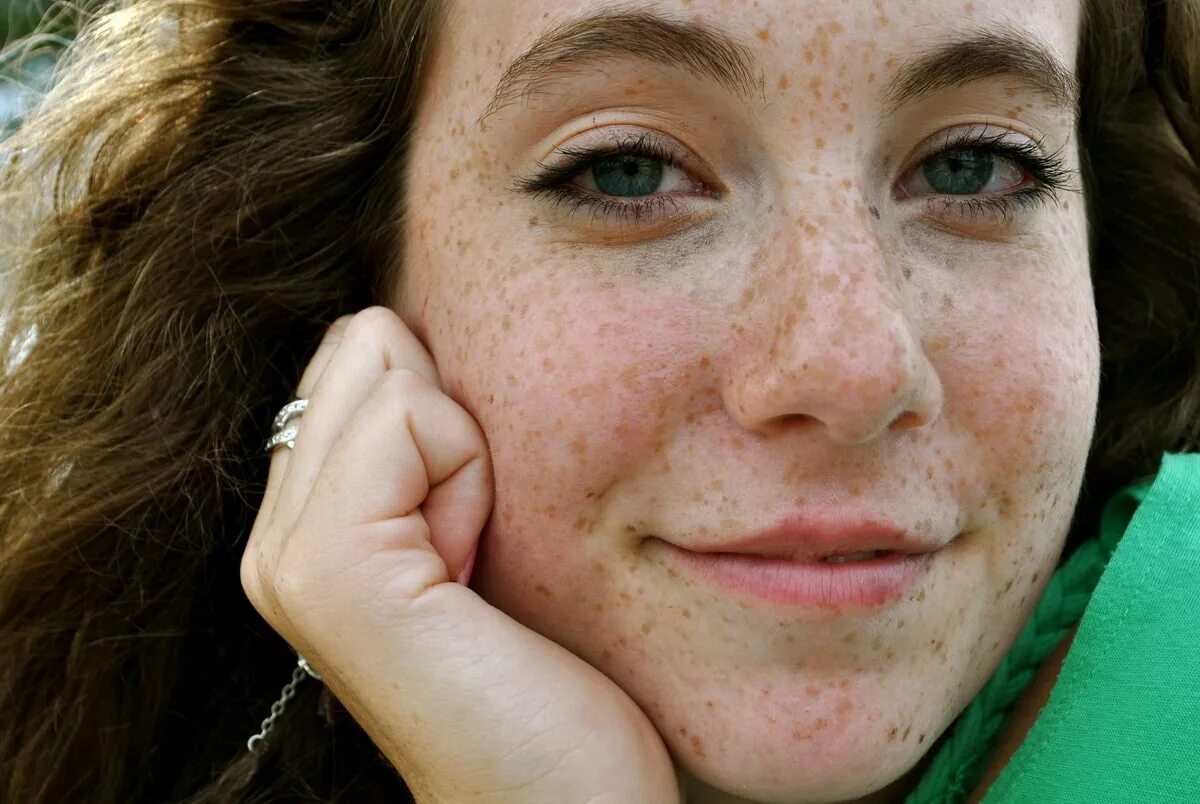 ее веснушки на лице