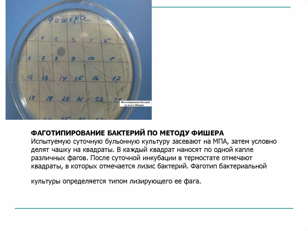 Фаготипирование применяется для. Фаготипирование бактерий по методу фишера. метод фаготипирования микробиология. фаготипирование стафилококков. фаготипирование кишечной палочки.