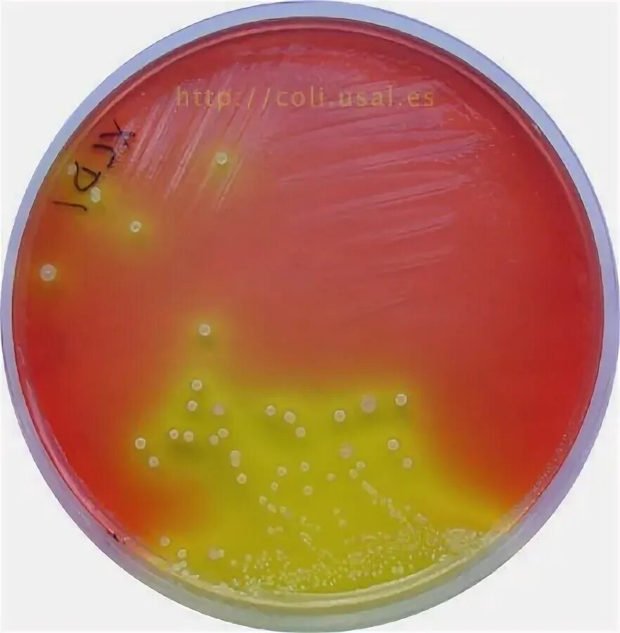 Spp salmonella spp shigella spp. Агар xld shigella. сальмонелла на xld агаре. xld агар шигелла. рост сальмонелл на среде xld.