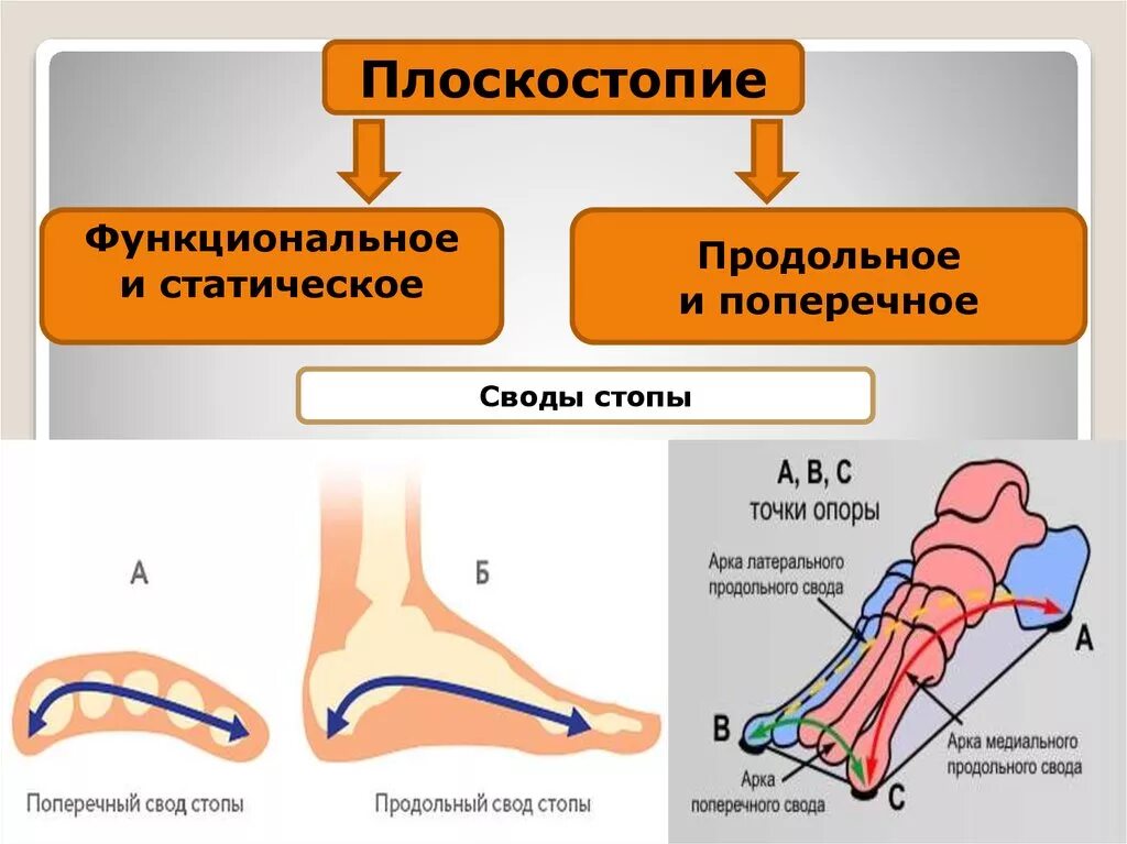 Строение поперечного свода стопы. Продольный и поперечный свод стопы. Свод стопы плоскостопие анатомия. Внутренний продольный свод стопы.