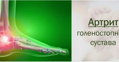 Лечение голеностопного сустава препараты