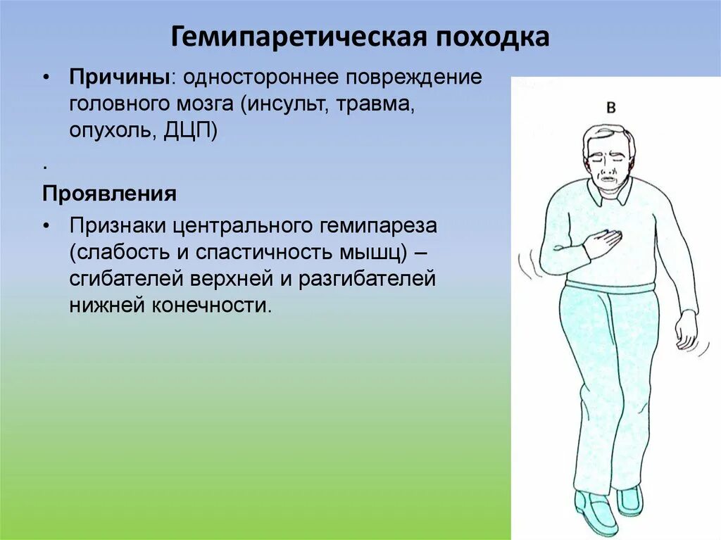 Гемипаретическая походка. Спастическая гемиплегическая походка. Гемипаретическая походка Вернике. Левый гемипарез